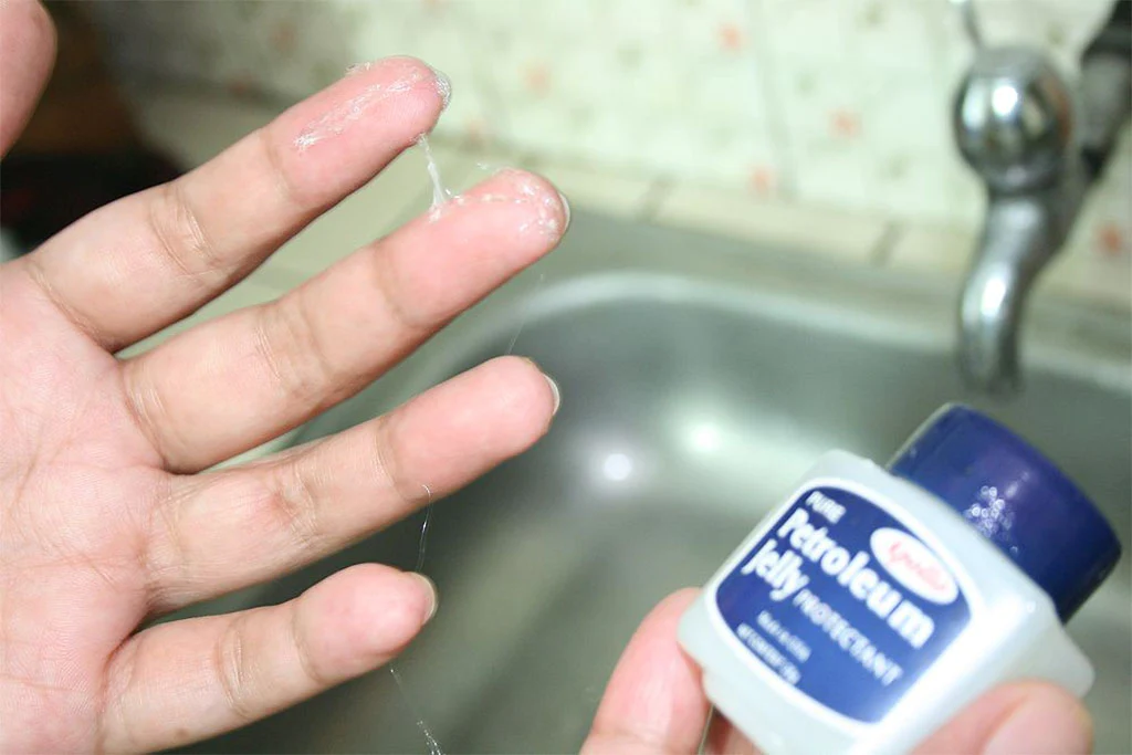 how to remove super glue from skin